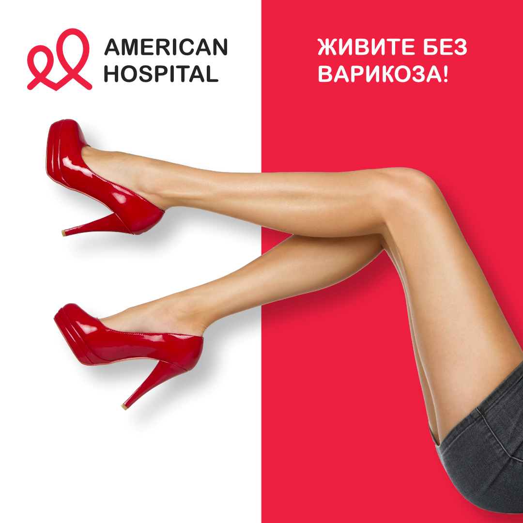 Опасности варикоза о которых вы не знали!