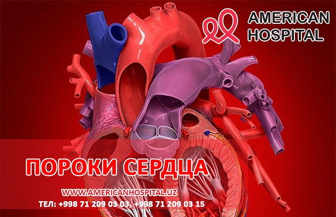 Пороки сердца