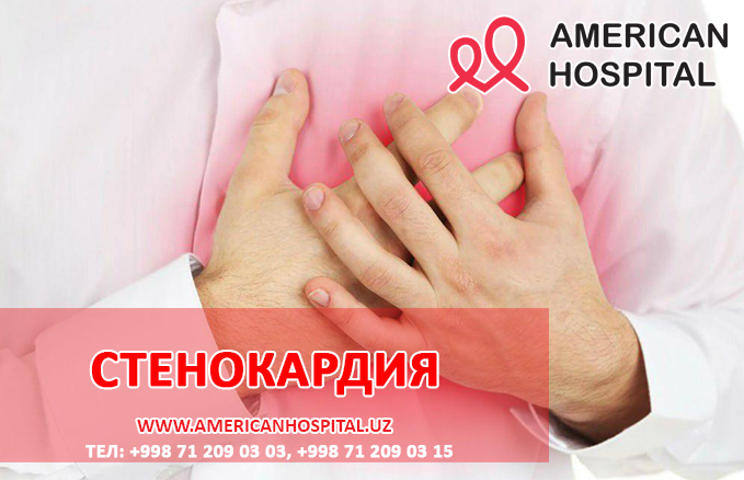 Стенокардия 